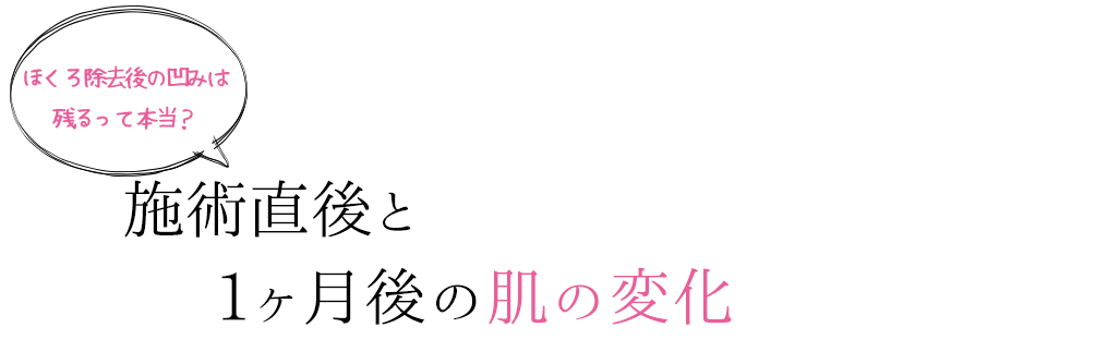 ほくろ除去後の凹みは残るって本当？施術直後と1ヶ月後の肌の変化
